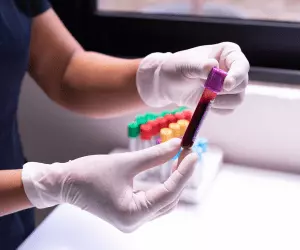 A person wearing white gloves holds a tube of blood